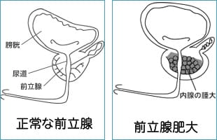 精子 に 血 が 混ざる